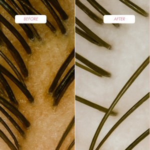 Hair Growth Stimulation Set – Shampoo, Mask and Peeling